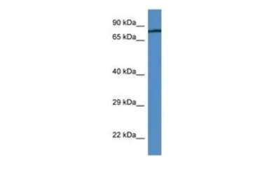 Anti-Coagulation Factor II antibody, N-term used in Western Blot (WB). GTX49012