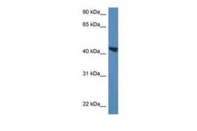 Anti-MEIS3 antibody, C-term used in Western Blot (WB). GTX49099