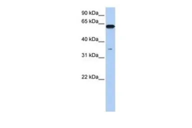 Anti-KPNA6 antibody, N-term used in Western Blot (WB). GTX49108