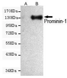 Anti-CD133 antibody [6H10-F1-C11] used in Western Blot (WB). GTX49150