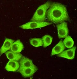 Anti-DR5 antibody [7F4-F8-G11] used in Immunocytochemistry/ Immunofluorescence (ICC/IF). GTX49151