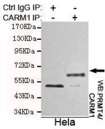 Anti-CARM1 antibody [2B9-H11-H10] used in Immunoprecipitation (IP). GTX49171