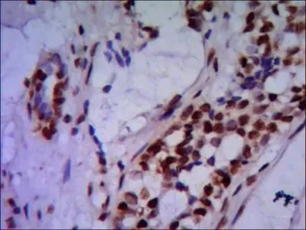 Anti-PRMT6 antibody [2C3-F1-G1] used in IHC (Paraffin sections) (IHC-P). GTX49197