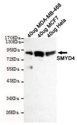 Anti-SMYD4 antibody [7C8-B11-F10] used in Western Blot (WB). GTX49257