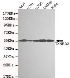 Anti-TXNRD2 antibody [3F2-E12-F10] used in Western Blot (WB). GTX49270
