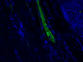 Anti-C4C antibody [99-72-18] used in Immunocytochemistry/ Immunofluorescence (ICC/IF). GTX49368