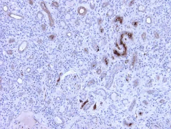 Anti-C4C antibody [99-72-18] used in Immunohistochemistry (IHC). GTX49368
