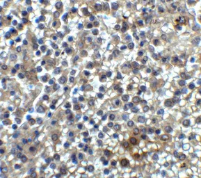 Anti-TIM-3 antibody used in IHC (Paraffin sections) (IHC-P). GTX49381