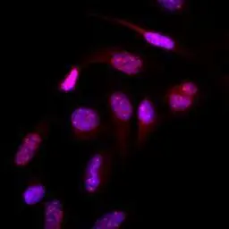 Anti-SUMO2 antibody [AT10F1] used in Immunocytochemistry/ Immunofluorescence (ICC/IF). GTX50000