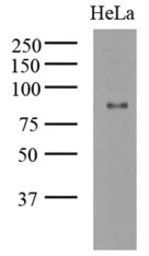 Anti-GCN5 antibody [AT3G13] used in Western Blot (WB). GTX50005
