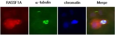 Anti-RASSF1A antibody [3F3] used in Immunocytochemistry/ Immunofluorescence (ICC/IF). GTX50075