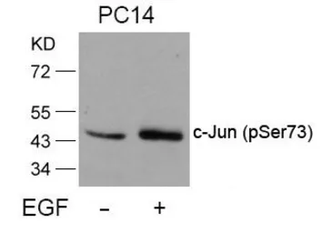 Anti-c-Jun (phospho Ser73) antibody used in Western Blot (WB). GTX50091