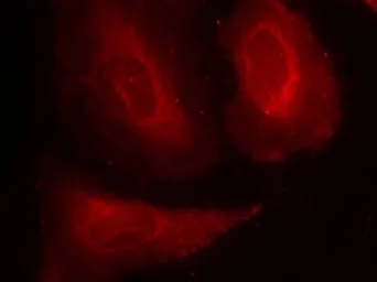 Anti-PDPK1 / PDK1 (phospho Ser241) antibody used in Immunocytochemistry/ Immunofluorescence (ICC/IF). GTX50093