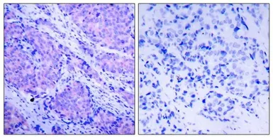 Anti-PDPK1 / PDK1 (phospho Ser241) antibody used in IHC (Paraffin sections) (IHC-P). GTX50093
