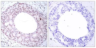 Anti-NFkB p65 (phospho Thr254) antibody used in IHC (Paraffin sections) (IHC-P). GTX50097