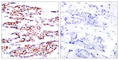 Anti-JunB (phospho Ser79) antibody used in IHC (Paraffin sections) (IHC-P). GTX50105