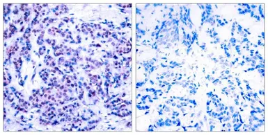 Anti-JunD (phospho Ser255) antibody used in IHC (Paraffin sections) (IHC-P). GTX50107