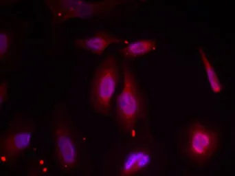 Anti-ATF2 (phospho Thr69) antibody used in Immunocytochemistry/ Immunofluorescence (ICC/IF). GTX50108