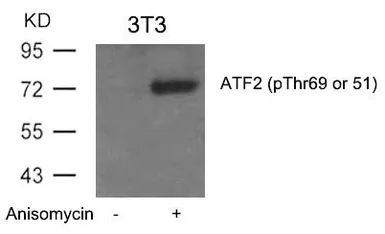Anti-ATF2 (phospho Thr69) antibody used in Western Blot (WB). GTX50108