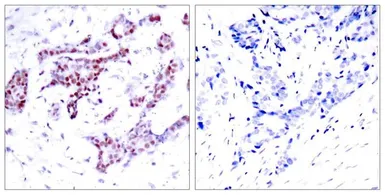 Anti-STAT1 (phospho Tyr701) antibody used in IHC (Paraffin sections) (IHC-P). GTX50118