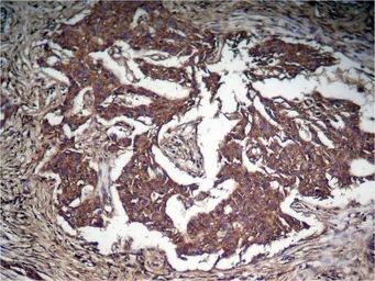 Anti-STAT3 (phospho Tyr705) antibody used in IHC (Paraffin sections) (IHC-P). GTX50119