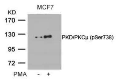 Anti-PKC mu (phospho Ser738) antibody used in Western Blot (WB). GTX50145