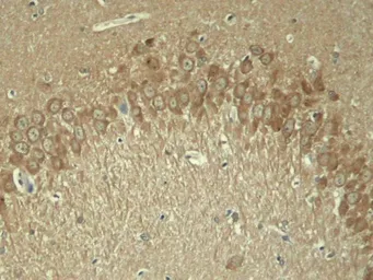 Anti-Tau (phospho Thr181) antibody used in IHC (Paraffin sections) (IHC-P). GTX50171