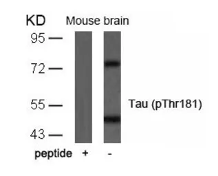 Anti-Tau (phospho Thr181) antibody used in Western Blot (WB). GTX50171