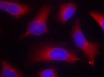 Anti-Tau (phospho Ser262) antibody used in Immunocytochemistry/ Immunofluorescence (ICC/IF). GTX50175