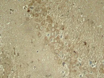 Anti-Tau (phospho Ser262) antibody used in IHC (Paraffin sections) (IHC-P). GTX50175