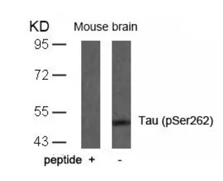 Anti-Tau (phospho Ser262) antibody used in Western Blot (WB). GTX50175