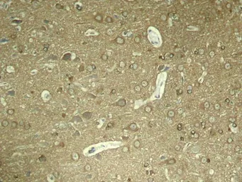 Anti-Tau (phospho Ser404) antibody used in IHC (Paraffin sections) (IHC-P). GTX50176