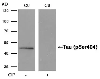 Anti-Tau (phospho Ser404) antibody used in Western Blot (WB). GTX50176