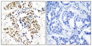Anti-ATM (phospho Ser1981) antibody used in IHC (Paraffin sections) (IHC-P). GTX50184