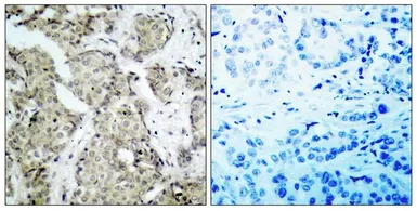 Anti-MEK6 (phospho Ser207) antibody used in IHC (Paraffin sections) (IHC-P). GTX50204