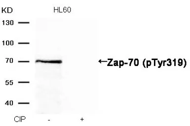 Anti-ZAP70 (phospho Tyr319) antibody used in Western Blot (WB). GTX50214