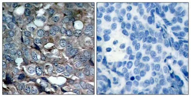 Anti-ASK1 (phospho Ser83) antibody used in IHC (Paraffin sections) (IHC-P). GTX50228