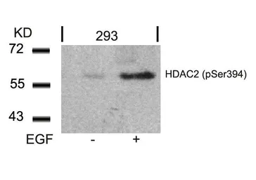 Anti-HDAC2 (phospho Ser394) antibody used in Western Blot (WB). GTX50236