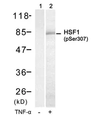 Anti-HSF1 (phospho Ser307) antibody used in Western Blot (WB). GTX50239
