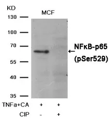 Anti-NFkB p65 (phospho Ser529) antibody used in Western Blot (WB). GTX50254