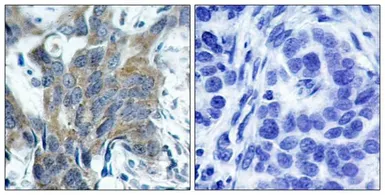 Anti-beta Catenin (phospho Ser33) antibody used in IHC (Paraffin sections) (IHC-P). GTX50255