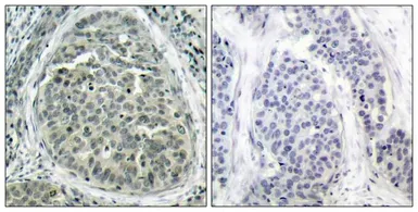 Anti-beta Catenin (phospho Ser37) antibody used in IHC (Paraffin sections) (IHC-P). GTX50256