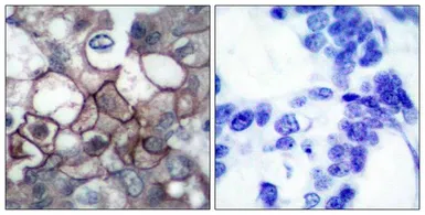 Anti-EGFR (phospho Tyr1173) antibody used in IHC (Paraffin sections) (IHC-P). GTX50263