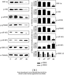 Anti-eIF4E (phospho Ser209) antibody used in Western Blot (WB). GTX50268