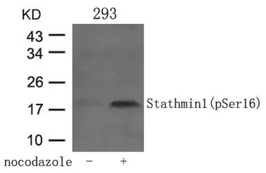 Anti-Stathmin 1 (phospho Ser16) antibody used in Western Blot (WB). GTX50269