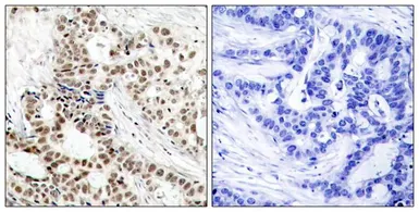 Anti-BRCA1 (phospho Ser1423) antibody used in IHC (Paraffin sections) (IHC-P). GTX50272