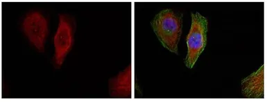 Anti-ERK1 (phospho Thr202) + ERK2 (phospho Thr185) antibody used in Immunocytochemistry/ Immunofluorescence (ICC/IF). GTX50274