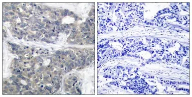 Anti-p70 S6K (phospho Thr421) antibody used in IHC (Paraffin sections) (IHC-P). GTX50282