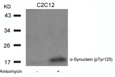 Anti-alpha Synuclein (phospho Tyr125) antibody used in Western Blot (WB). GTX50284