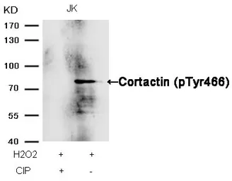 Anti-Cortactin (phospho Tyr466) antibody used in Western Blot (WB). GTX50295